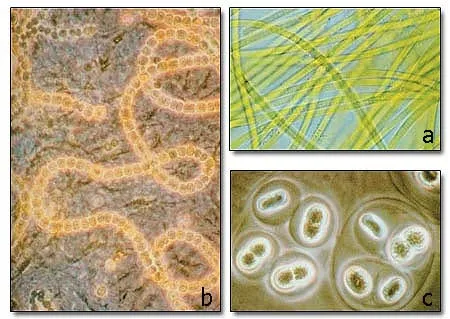 The pictures show three types of cyanobacteria. (a: Nostoc, b: Oscillatoria, and c: Gleocapsa). These bacteria, which live in clean waters, have exceptionally c