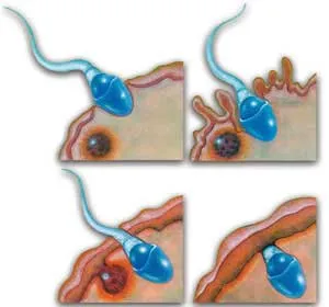 Just one out of millions of sperms succeeds in piercing the protective shell around the egg. In the final stage, the sperm's tail breaks off and is left outside