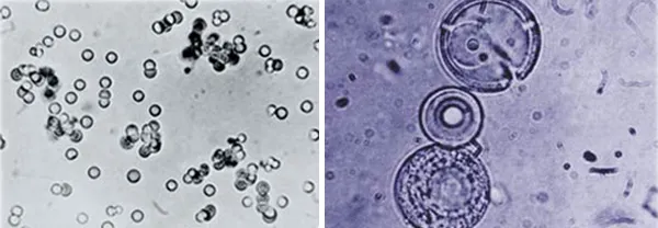 Fox’s “Proteinoids” Under the influence of Miller’s scenario, Stanley Fox combined certain amino acids to form the molecules above, which he called proteinoids.